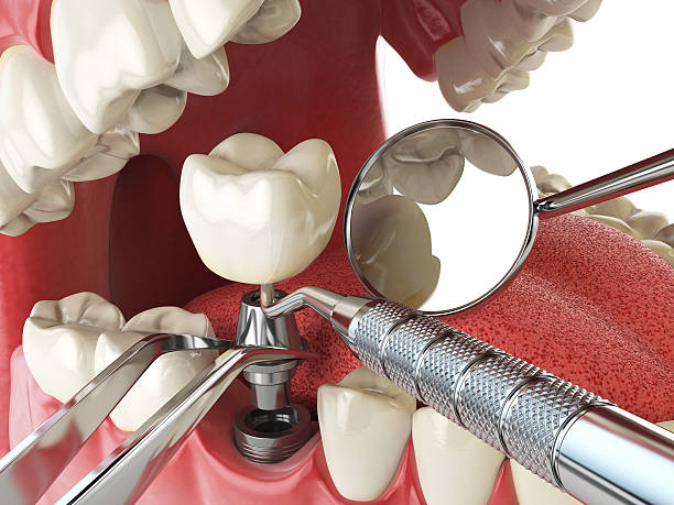 Best Emergency Dental Surgery in Lakeland, GA